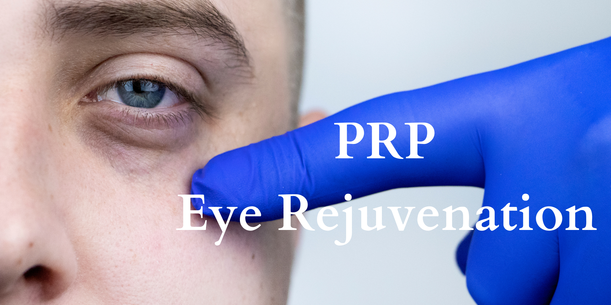 PRP Eye Rejuvenation